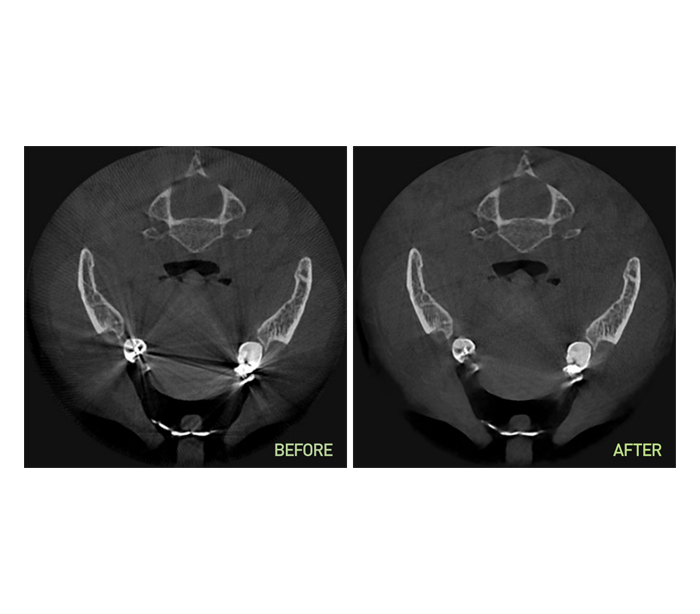 Genoray - Papaya 3D Plus (OPG) X-Ray Imaging System